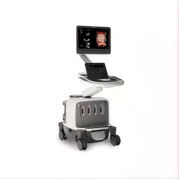 EPIQ CVx, our premium cardiovascular ultrasound system built on our innovative, modular, industry-leading ultrasound platform, has powerful AI-based capabilitie...